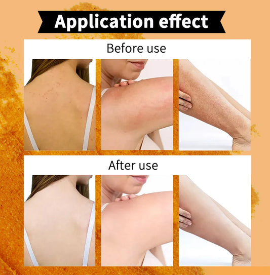 Natural Body Scrub - Moisturizing and Exfoliating Body, Face, Hand, Foot Scrub - Lightening, Fine Lines & Wrinkles, Skin Glowing