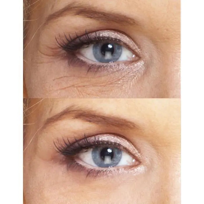 Biotic Repair Eye Treatment - Leisure Life USA