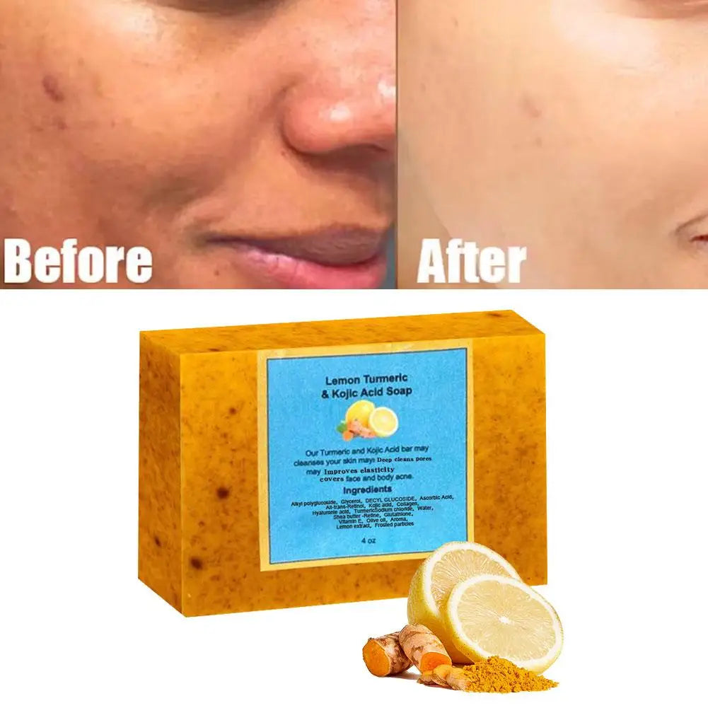 Natural Turmeric & Lemon Brightening Skin Soap Face Deep Cleansing Pore & Mite Removal Soap Exfoliate Oil Control Skin Care Soap