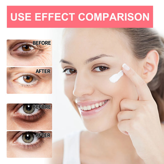 Retinol Eye Treatment Cream Stick