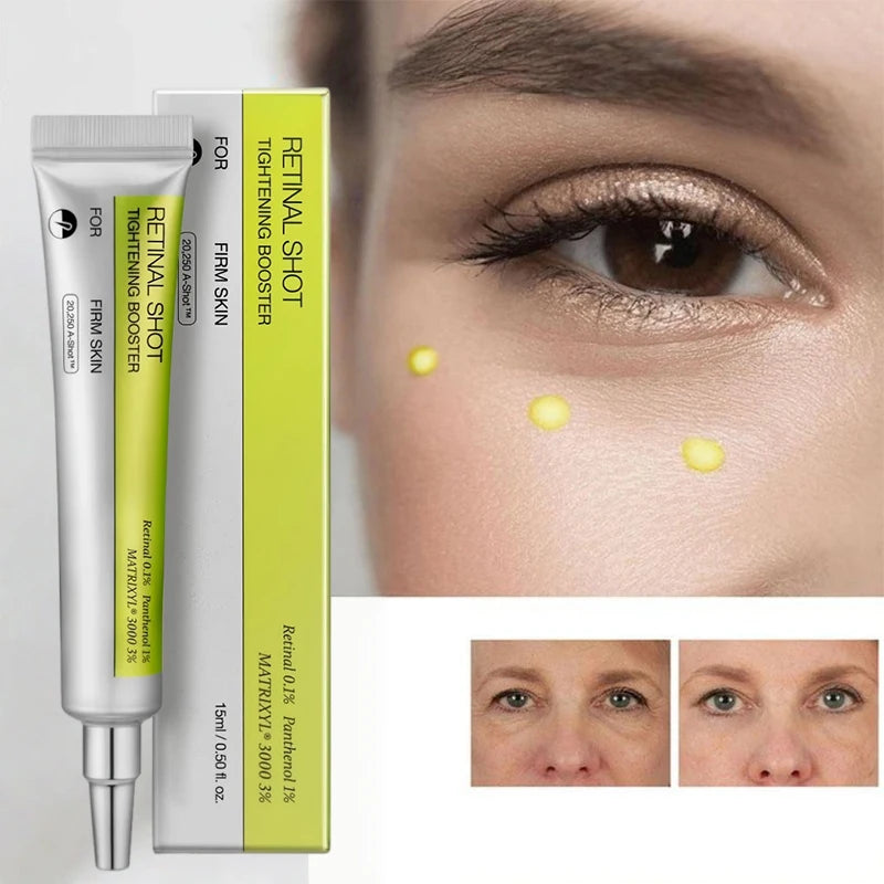 Korean Eye Cream For Anti-wrinkle & Age Retinol Eye Cream Remove Dark Circles Against Puffiness And Bags Hydrate Eye Care Cream